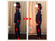 キララ 美容矯正/U24クーポン多数ご用意