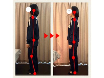 キララ 美容矯正/U24クーポン多数ご用意