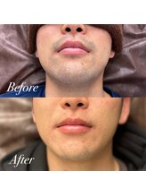 ボス 大曽根店(BOSS)/ひげ剃りストレス解放