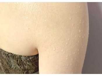 香嬉琉/冷えやコリを感じていませんか？