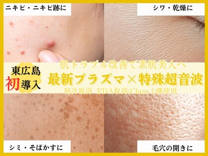 サンティエ(Santie)の写真