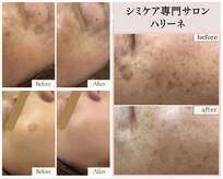 ハリーネ(HARINE)