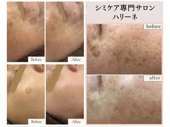 ハリーネ(HARINE)