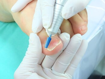 巻き爪補正店 秋葉原店の写真/《巻き爪/魚の目/タコ/角質ケア》特許取得技術×足のスペシャリストによるトラブルケア専門店◎[秋葉原]