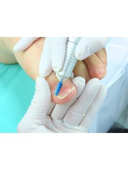 フットケアを受けたい