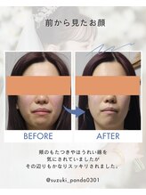 すずき接骨院/顎関節施術｜5週間での変化