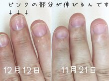 ネイルネイル 南森町店(nailnail)の雰囲気（どれだけ短いお爪でもスカルプ付けられます〇）