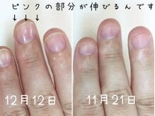 どれだけ短いお爪でもスカルプ付けられます〇