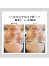 ポムハヌル(pom.haneul)/韓国肌管理室