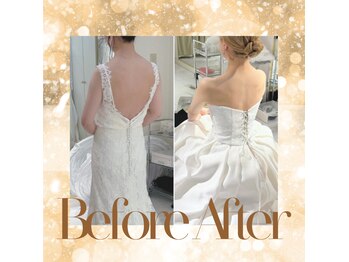 美容整骨小顔ラボ/ビフォーアフター