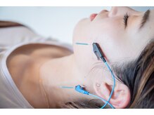 ハリファ鍼灸院 熊本院(HariFa鍼灸院)/美容鍼