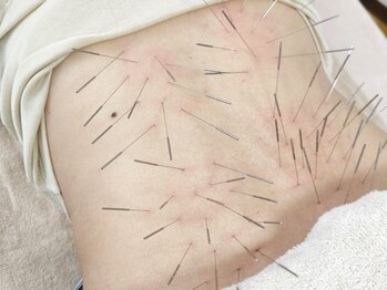 きやま鍼灸治療院/