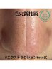 とれた毛穴の汚れが見える毛穴エクストラクション(90分)