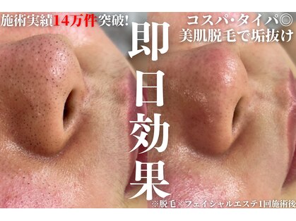 アルゴ 越前店(ALGO)の写真