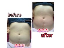 アンリール 苫小牧店(ANRIRE)/ボディー施術のお客様です