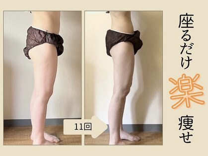 ミリュー(mylieu)の写真
