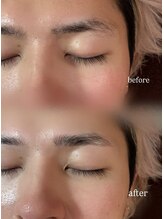 チック(chic)/メンズアイブロウ