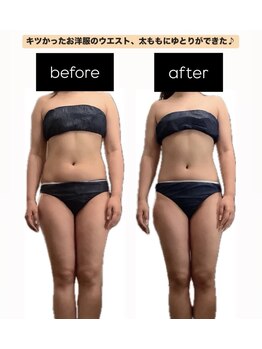 スラン(Slan)/肩こり、むくみ改善、痩身