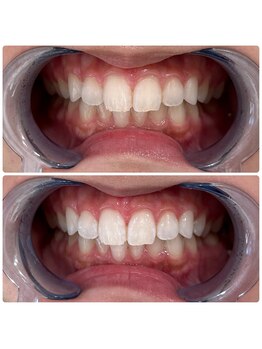 エクシアホワイトニング 日本橋店/セルフホワイトニングサロン