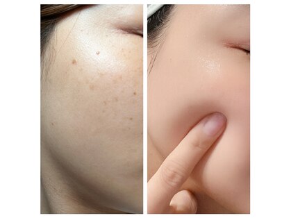 コーヴォ(COVO)の写真