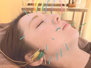 茶ノ木鍼灸整骨院の写真/ハイクオリティな美容鍼も術後インディバケアも通いやすい価格設定で大好評◎