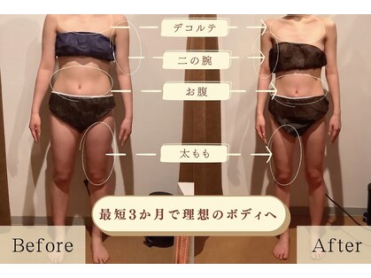 ブルーム(Bloom)の写真