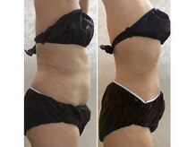 オンディーヌ 名古屋/劇的に!!エステ通いは最短で卒業