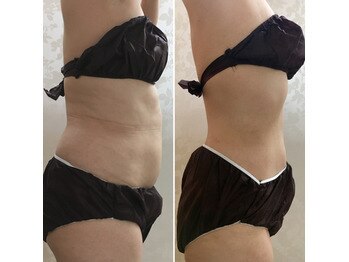 オンディーヌ 名古屋/劇的に!!エステ通いは最短で卒業