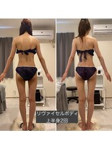 グラニット(Granit.)/ボディBeforeAfter