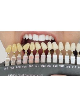 定額/月額メニューのあるサロン