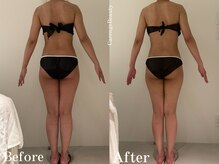 カレンジェビューティー(CarengeBeauty)/四日市痩身/スリムカッター