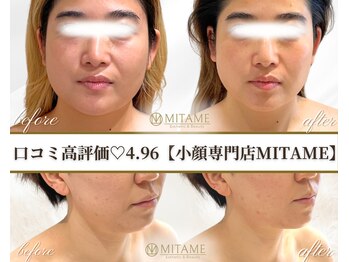 ミタメ 銀座店(MITAME)