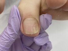 爪処 中野坂上/トラブル爪