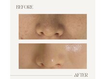 ホジュン鍼灸整体院/