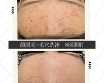 モアトゥインクル 福山神辺店(MORE twinkle)