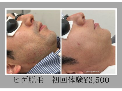 エピリス(EPILIS)の写真
