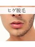 メンズ人気No2【メンズヒゲ脱毛】（頬、鼻下、顎、首含む）50％OFF！（45分）