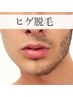 メンズ人気No2【メンズヒゲ脱毛】（頬、鼻下、顎、首含む）50％OFF！（45分）