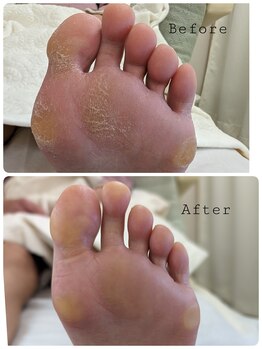 リゼラアンドコー 旭川店/before　after