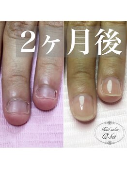 ネイルサロン キュービット(Q-bit)/