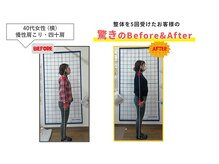 にこにこ整体 整骨院/【四十・猫背矯正】整体をBE⇒AF