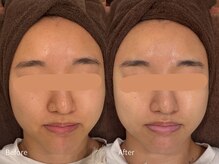 アウラ 小杉店(AULA)/ララピール☆