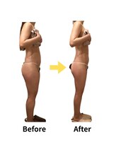 ムーロ(muro.)/BeforeAfter