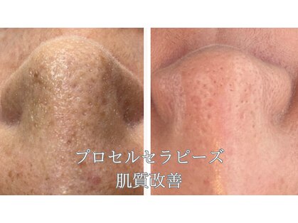 七や美肌の写真