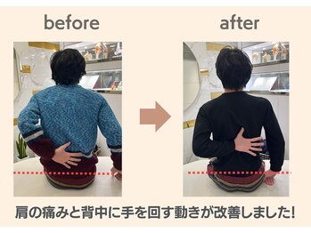 フィクシブ 上野(FIXIBE)/背中に手が回るようになりました