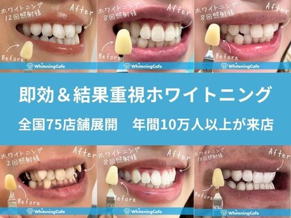 ホワイトニングカフェ 苫小牧店(WhiteningCafe)の写真