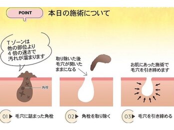 美プラス/毛穴洗浄