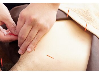 オリガミ鍼灸接骨院 旭丘院/鍼灸施術