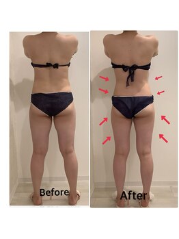 スペチアーレ 夙川/顔もボディも大変身♪