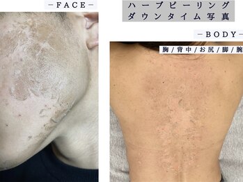 シャルムクリニカルサロン 池袋(Charme clinical salon)/